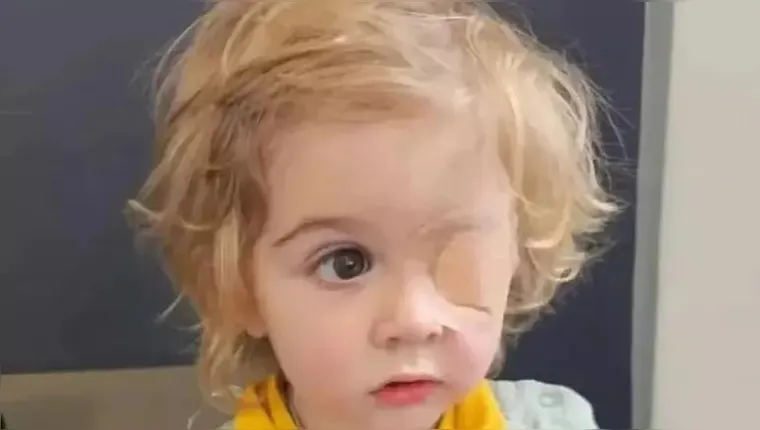 Criança pode ter ficado cega após ganhar beijo no olho; entenda