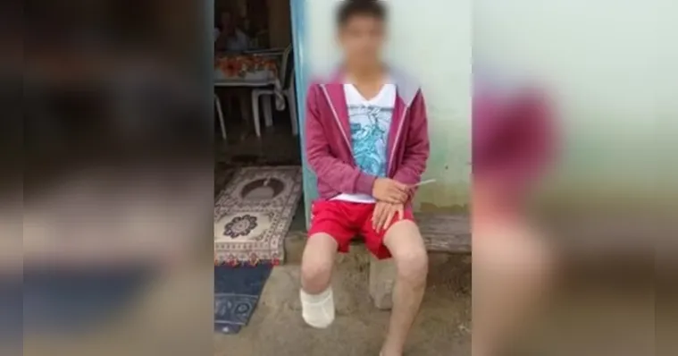 O servidor público teria amputado o próprio pé para ter direito ao valor milionário do seguro | Foto/Arquivo Pessoal